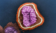 Im CSSB soll bspw. das Zusammenspiel von Proteinen bei medizinisch relevanten Infektionen durch Viren, Bakterien oder Parasiten entschlüsselt werden. Hier: elektronenmikroskopische Aufnahme eines Influenza-Viruspartikels. Quelle: DESY